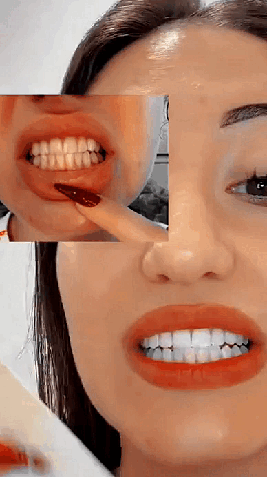 (Nuevas) Tiras Dentales Antiamarilleo Moradas "Fórmula Concentrada" ⭐️